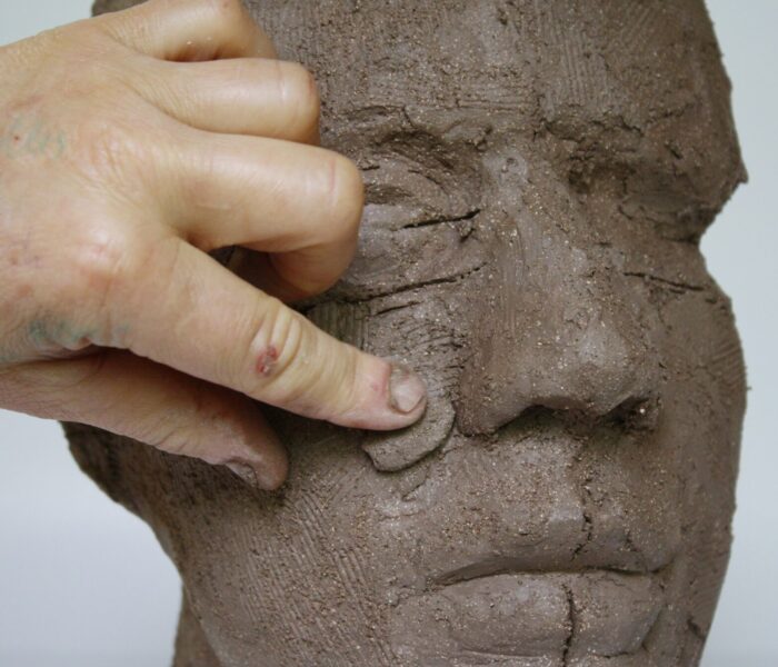 0164_58building up cheek philtrum area crease
